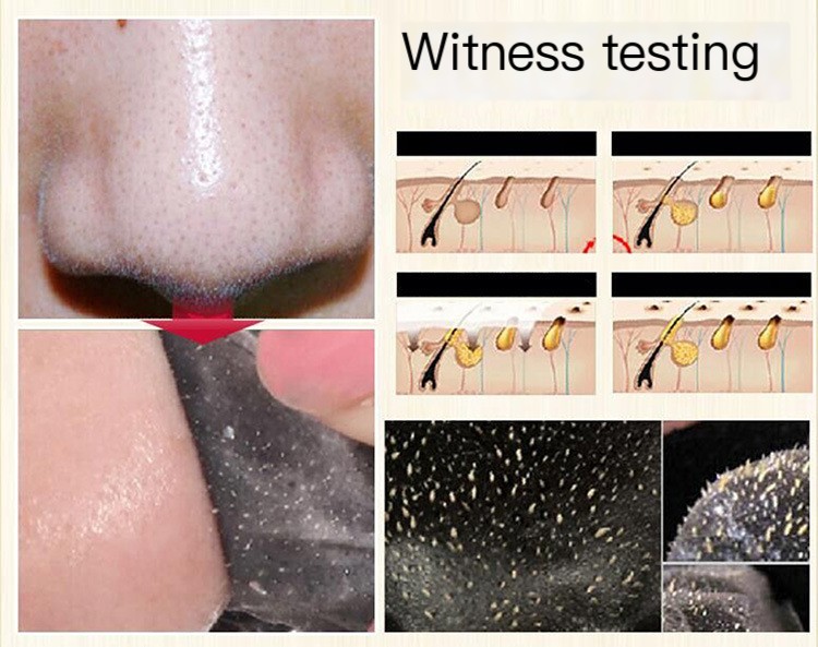 Blackhead Mask Application