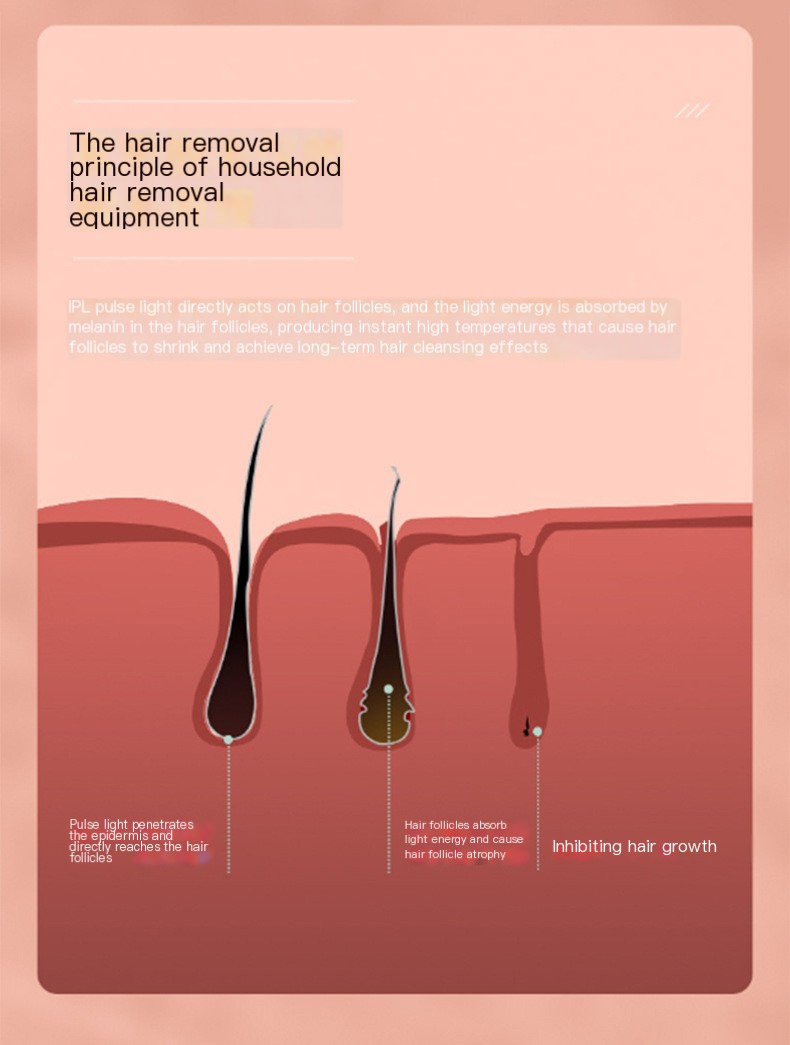 Hair Removal Device Image 4