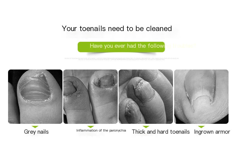 Nail Trench Pliers - Image 1