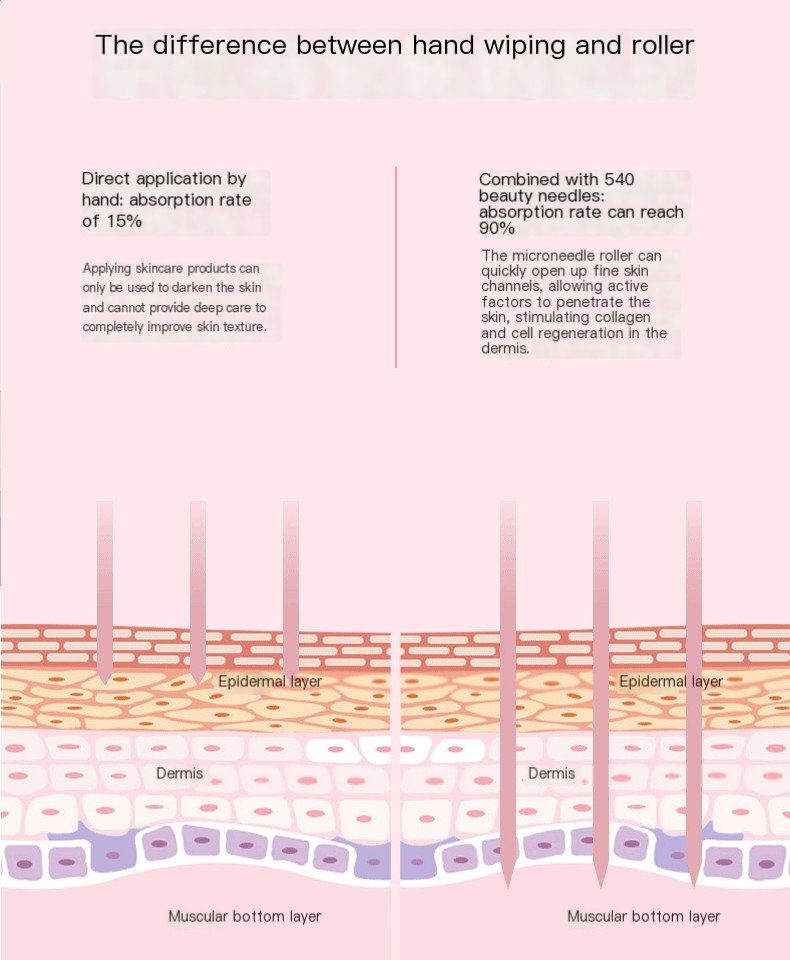 Micro-Needling Device