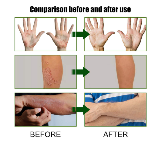 Cowhide Moss Repair Cream Image 2