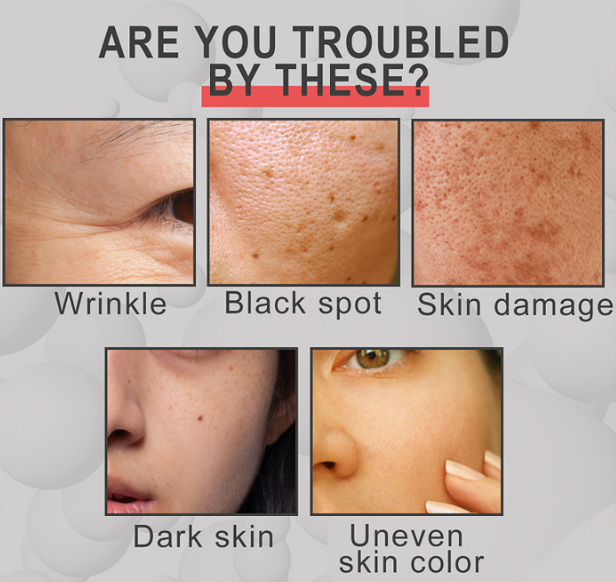 Skincare Solution