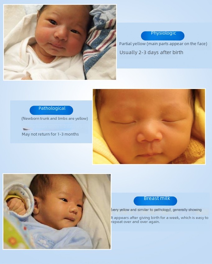 PAR38 Blue Light 450-460 Composite Blue Light Spotlight Household Yellow Removal Blue Light Newborn Yellow Removal Spotlight