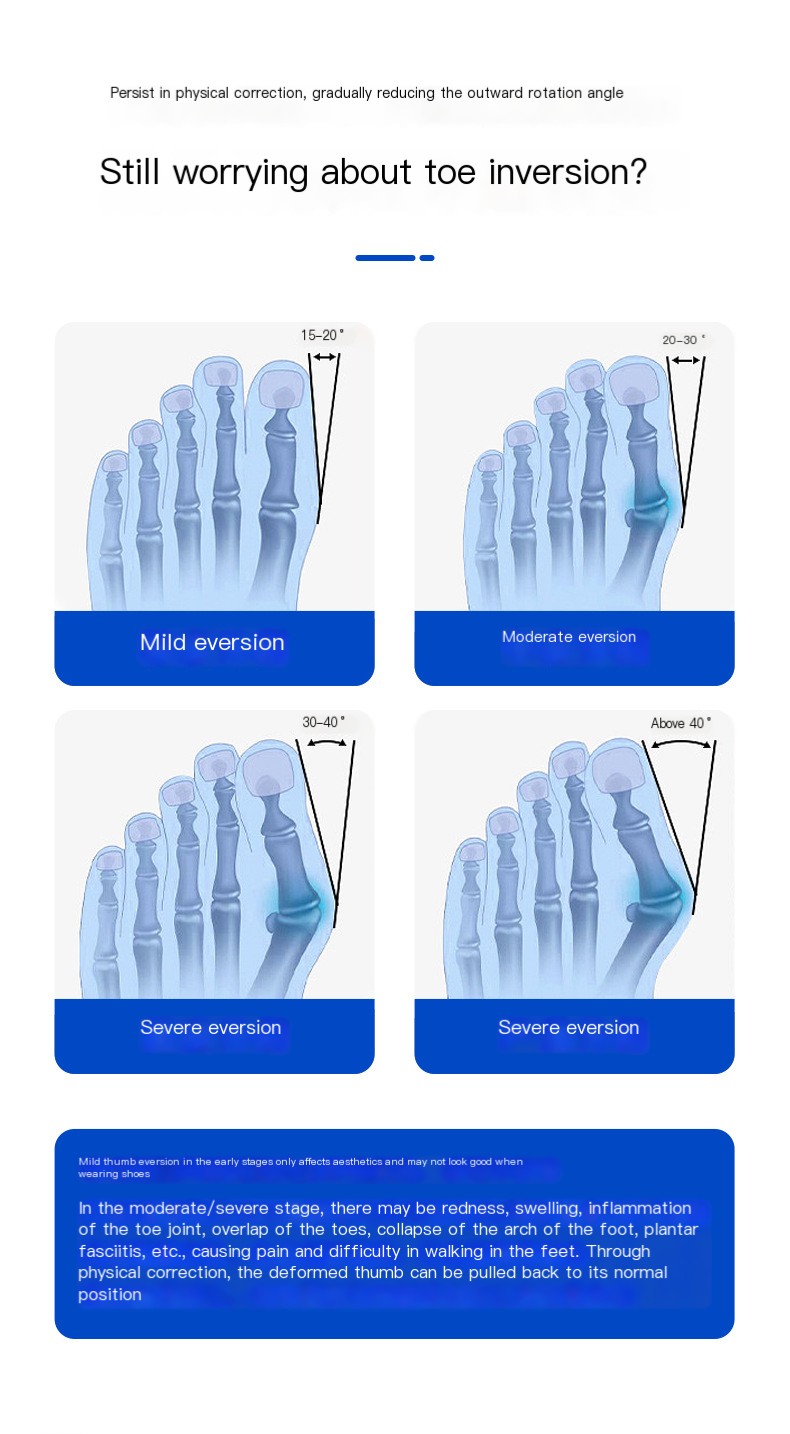 Upgraded Adjustable Thumb Corrector Image 2
