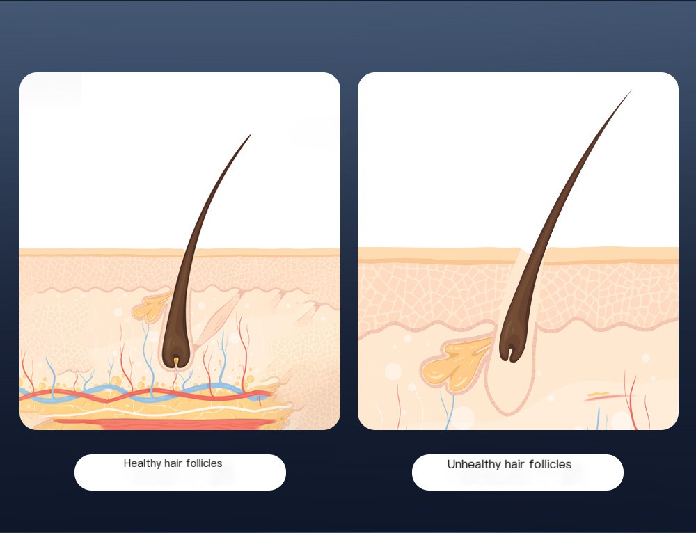 Hair Growth Comb Features