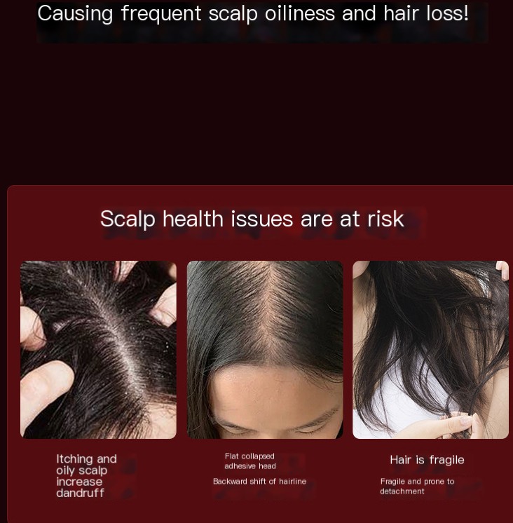 ScalpMate in Silver Gray