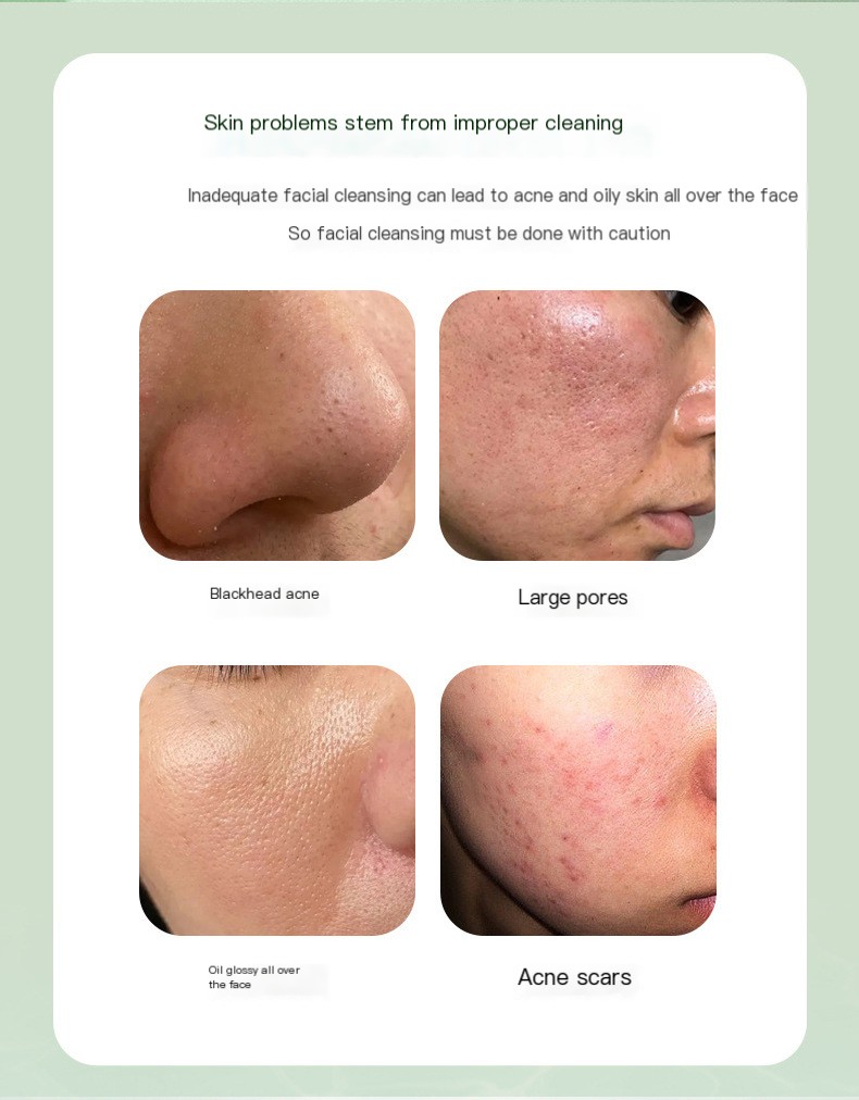 Centella Asiatica Bubble Mask Image 1