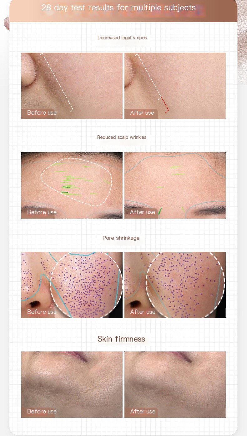 Beauty Instrument Image 2