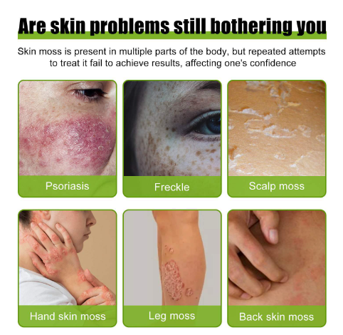 Cowhide Moss Repair Cream Image 3