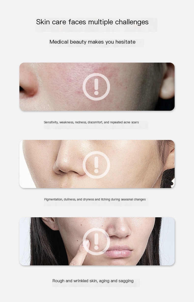 LED Silicone Beauty Mask Variations