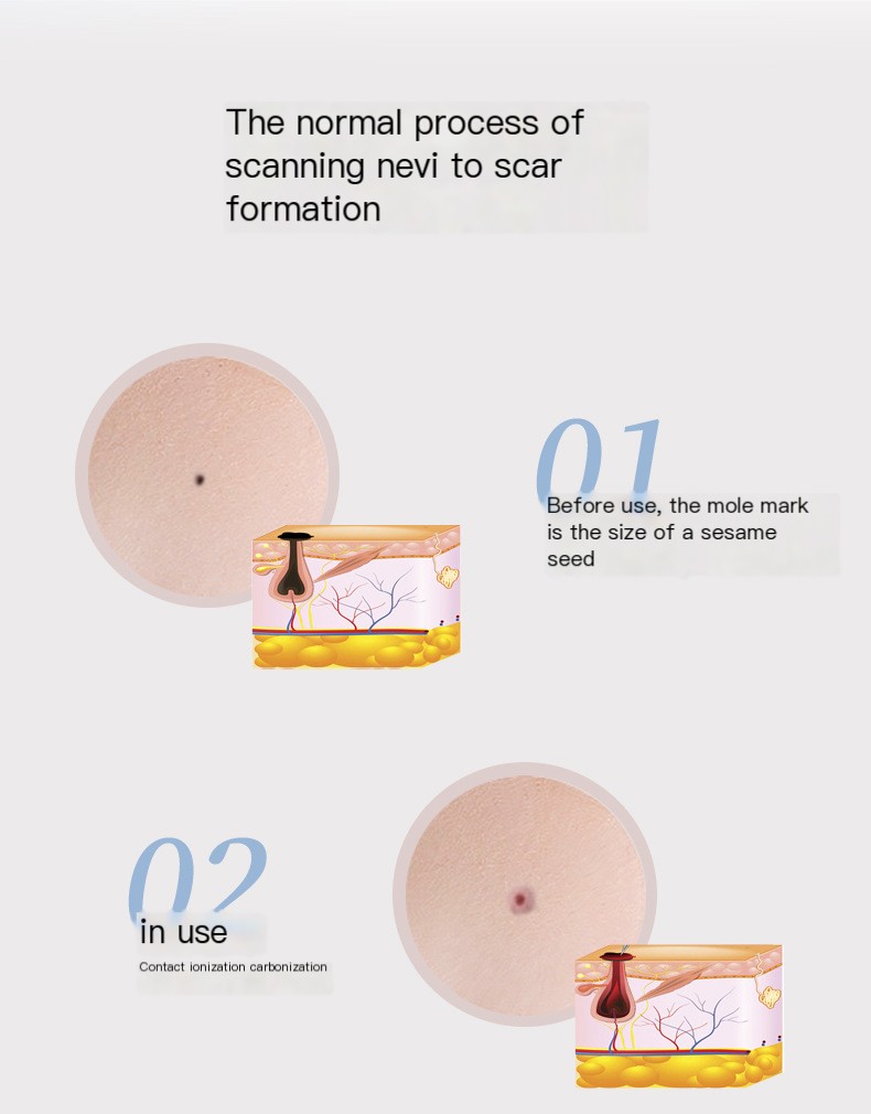 Beauty Mole Pen Image 6