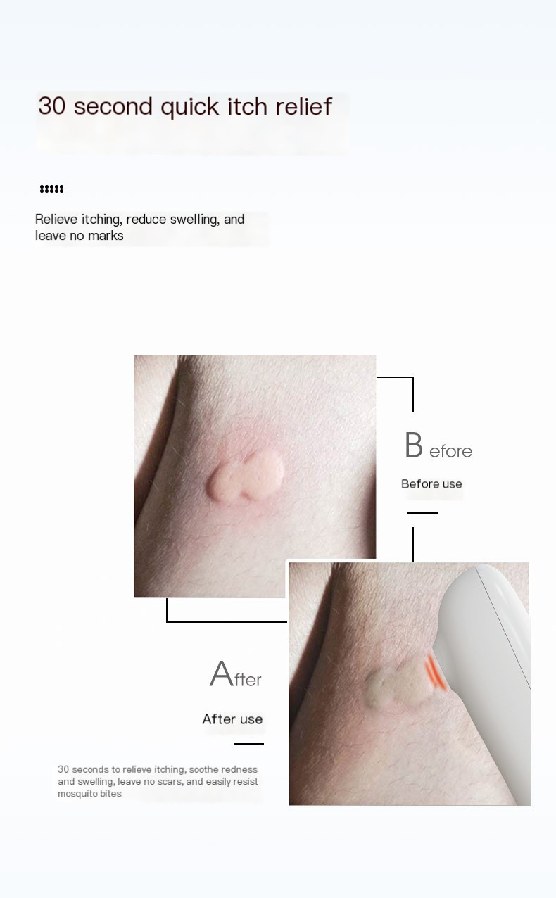 Mosquito Bite Relief Device