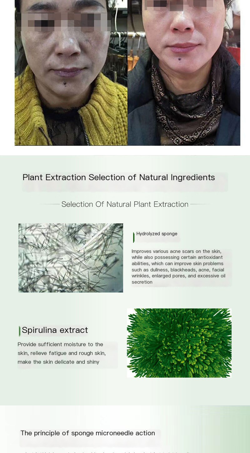 Seaweed silicone needle plant sponge micro needle skin rejuvenation bone needle acne pit acne marks repair skin dark yellow beauty salon special