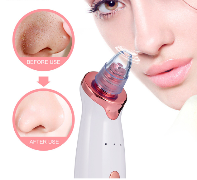 Blackhead Remover
