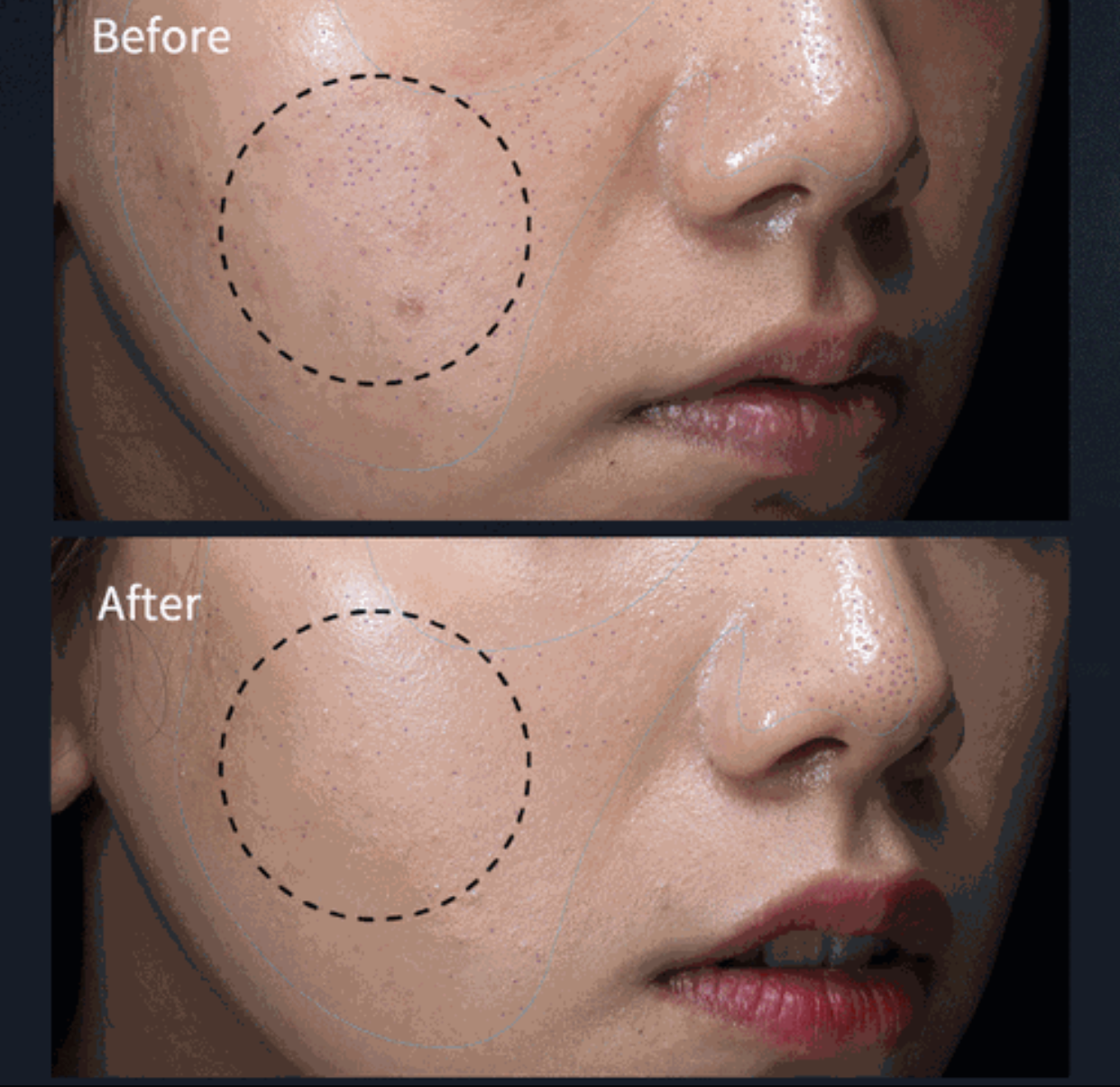 Beauty Mask in Action