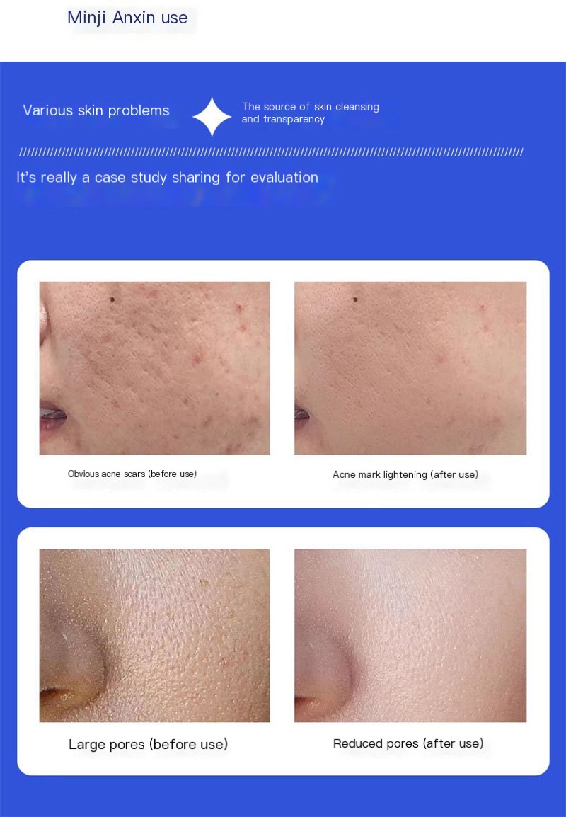 Skincare Solution