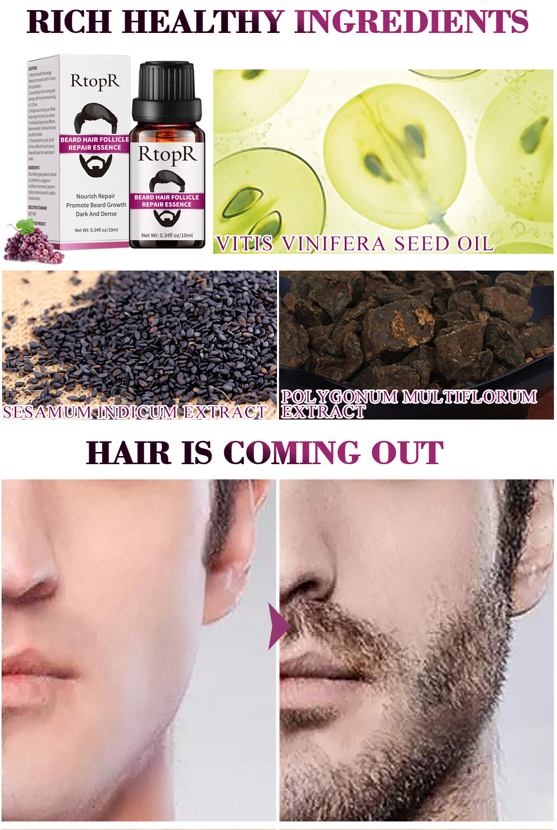 RtopR Beard Essential Oil