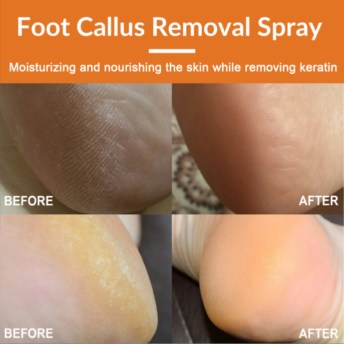 Foot Exfoliating Spray Image 4