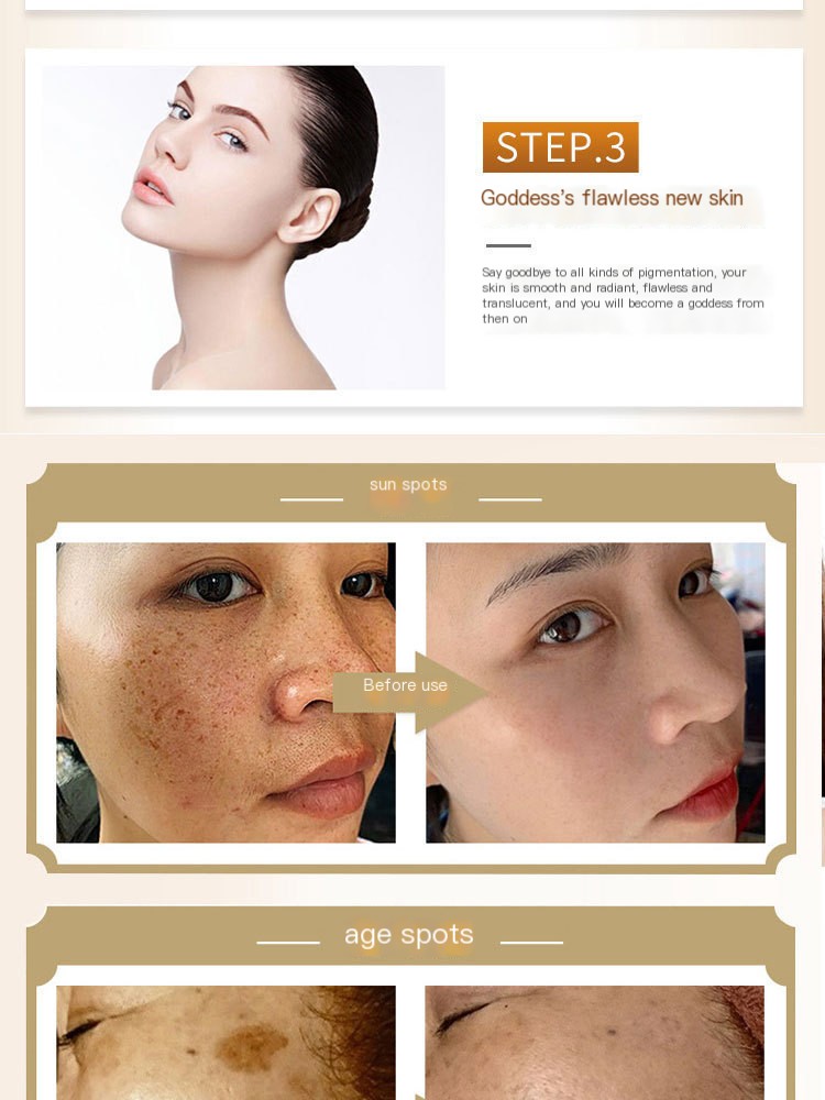 Herbal Astragalus Cream Results