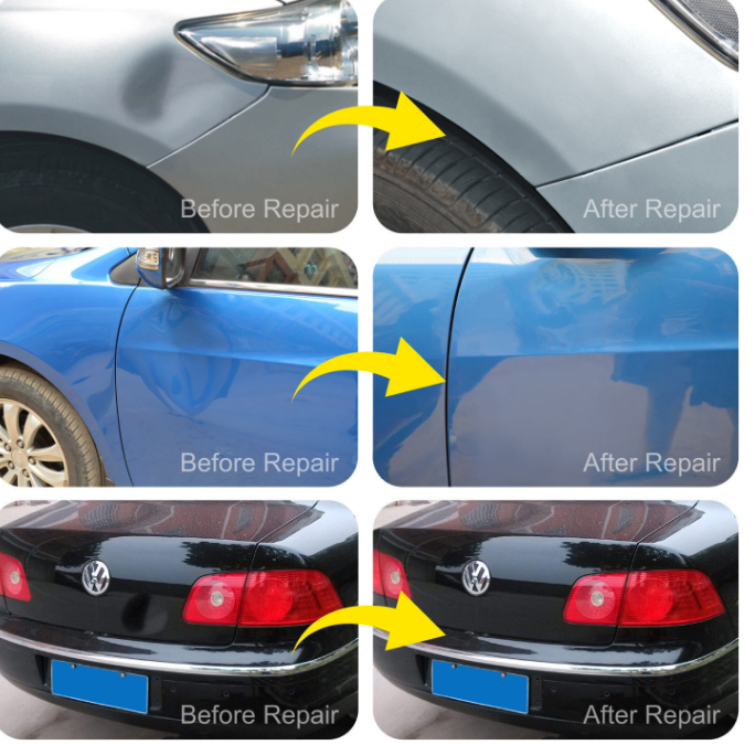 Automotive Dent Repair Tool Kit Image 4