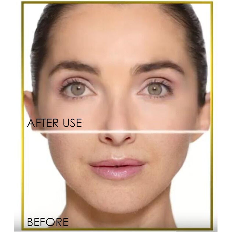 Smooth Skin with Flawless Dermaplane Glo