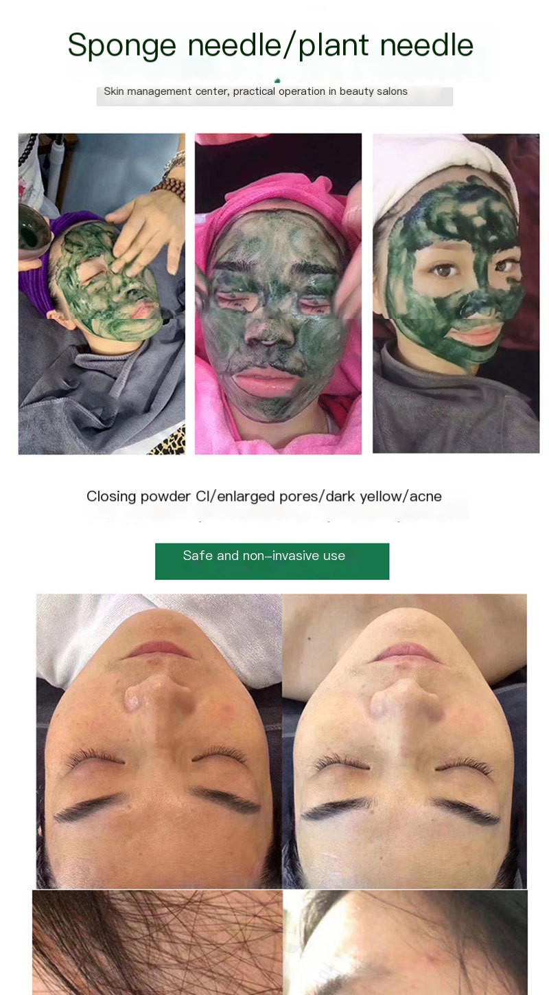 Seaweed silicone needle plant sponge micro needle skin rejuvenation bone needle acne pit acne marks repair skin dark yellow beauty salon special