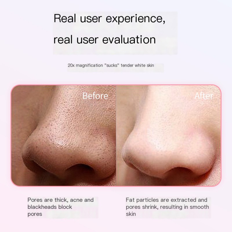 Blackhead Removal Device 4