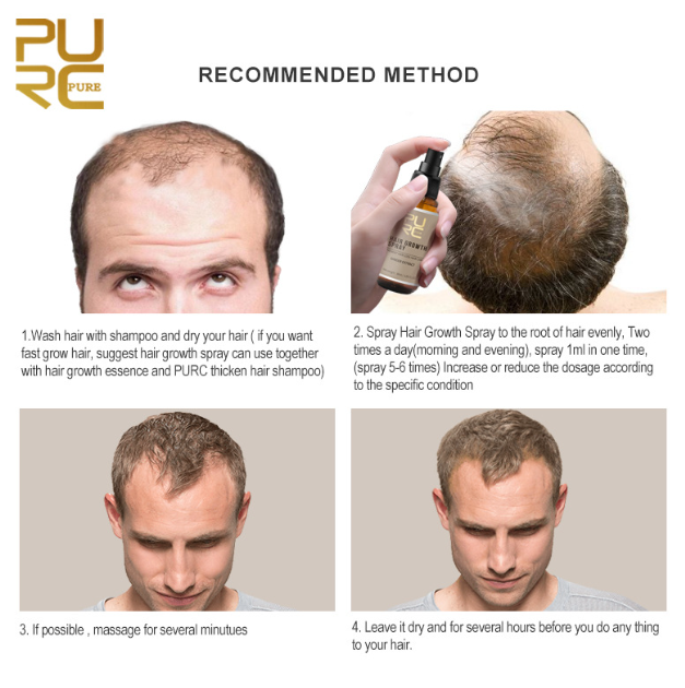 Hair Growth Spray Image 3