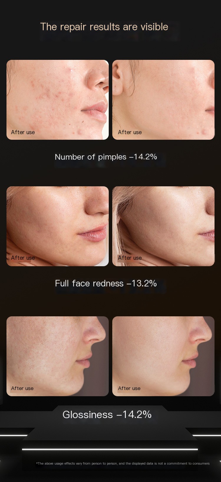 Beauty Device Image 4