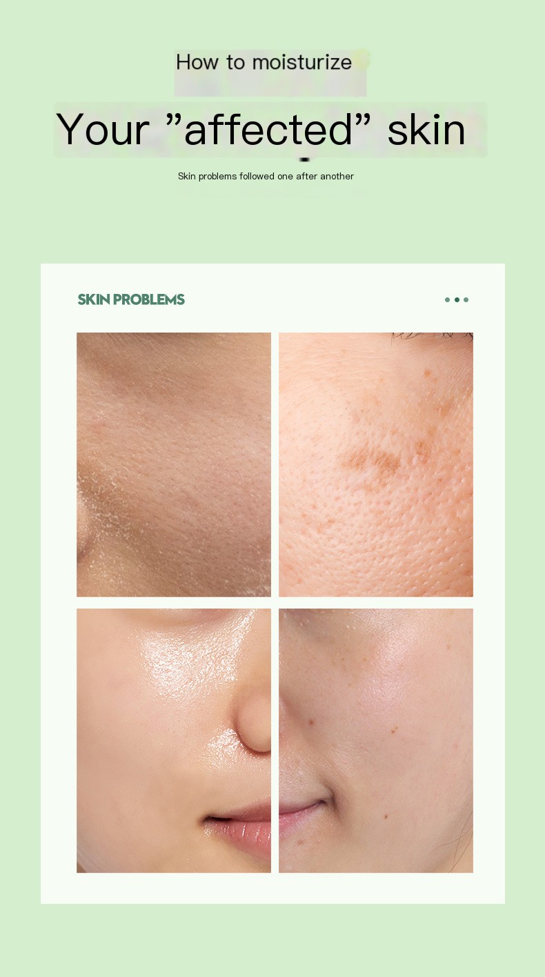 Zhengcai Aloe Vera Gel Image 3