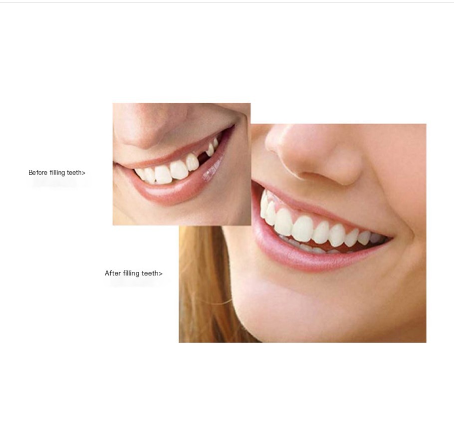snop on smile dental set image 6