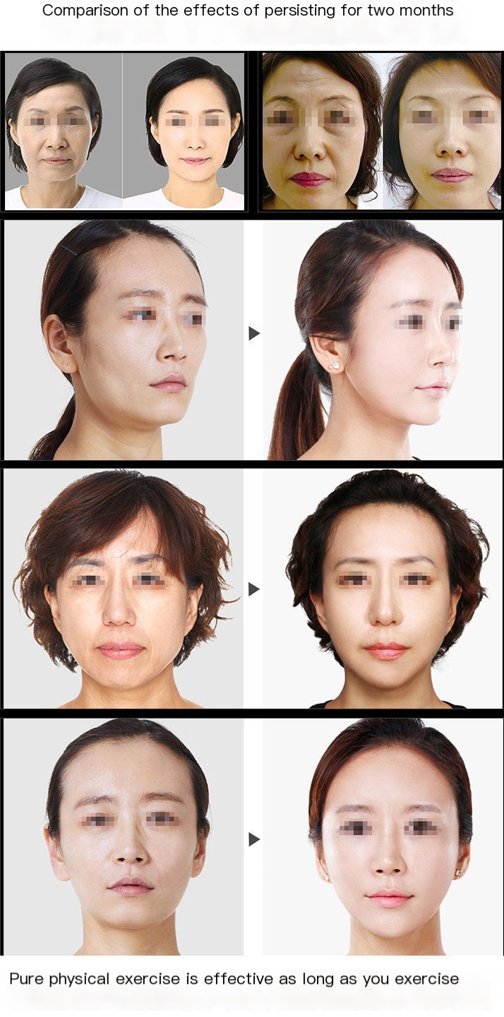 V脸瘦脸器 Image 2