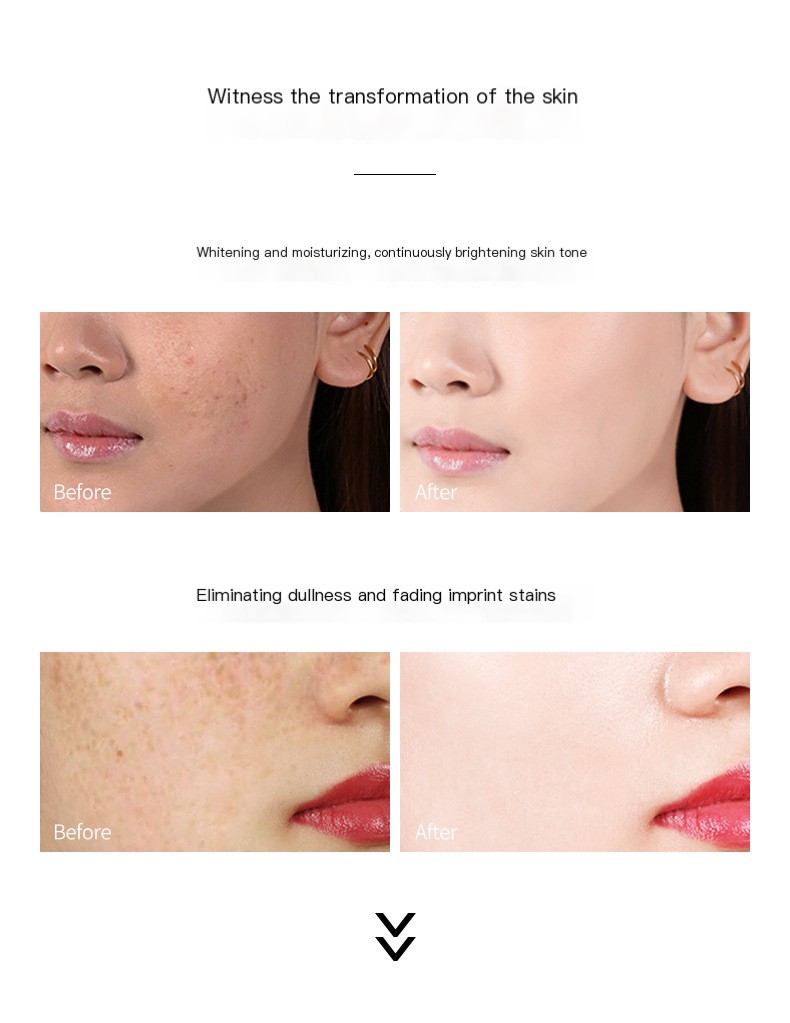 Whitening and Freckle-removing Cream Image 9