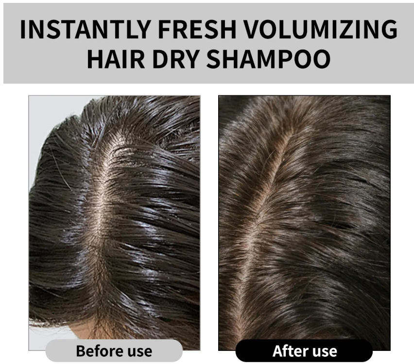 Dry Shampoo Image 1