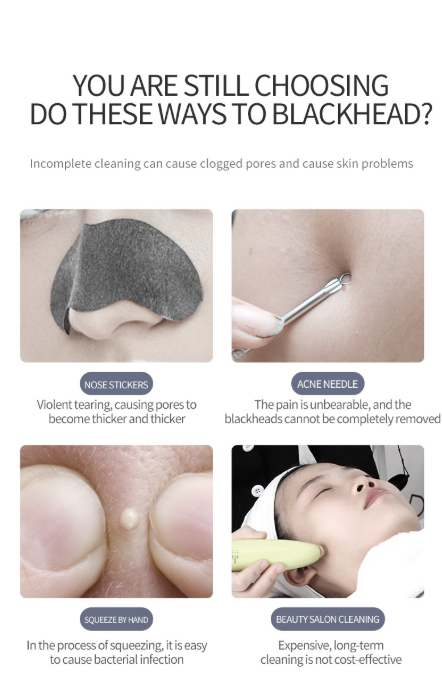 Skin scraper beauty device