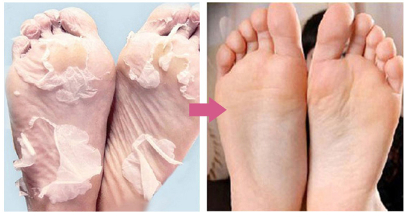 Lavender Essence Exfoliating Foot Mask